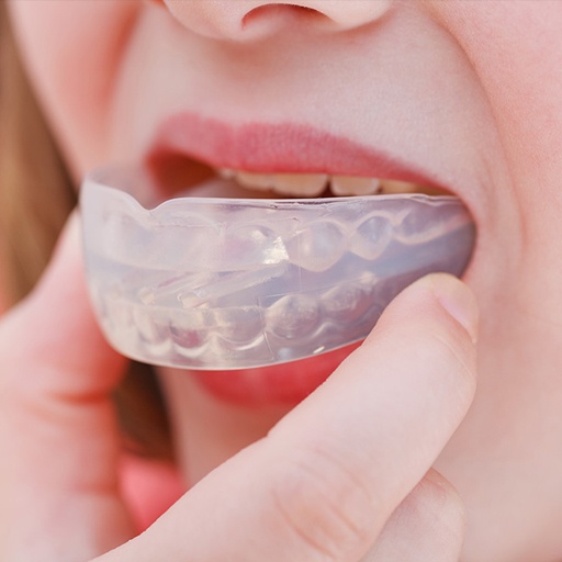 Mouthguards are made out of soft, flexible and rubber-like material. Athletes participating in contact sports wear mouthguard to protect their teeth and gum. Book in with Envisage Dental today to get your custom-made mouthguards today!